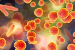 Bacteria leading to Pneumonia